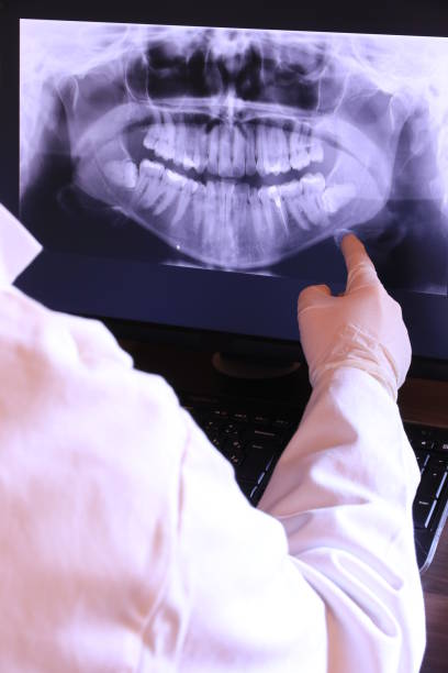 Best Broken Tooth Emergency  in Essex Fells, NJ
