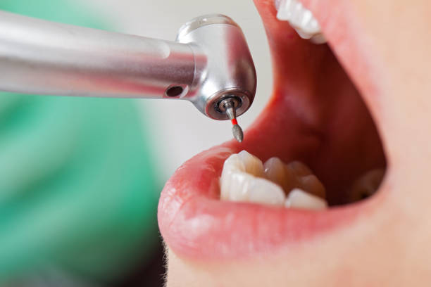 Best Dentist for Severe Toothache  in Essex Fells, NJ